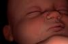 National Pro-Life Group Calls on DOJ to Settle Abortion Drug Lawsuit