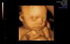 South Dakota Judge Blocks Ban on Advertising Abortion Pills
