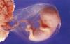Nebraska Abortions Increase 7.9% as Abortion Pills Kill More Babies