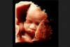 New York Forced to Destroy 150,000 Abortion Pills That Could Have Killed Babies