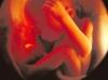 Judge Pauses Wichita Abortion Facility Lawsuit Over Chemical Abortion Drugs