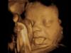Pro-Life Group Wants Federal Law Enforced to Stop Mail-Order Abortions