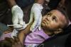 From Pulse Polio campaigns to boosting vaccine coverage in children, India’s healthcare efforts lauded globally