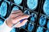 Rutgers and Weill Cornell Medicine Win $3M to Study HIV’s Toll on the Brain
