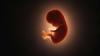 Alaska high court to decide if non-doctors can kill unborn babies with chemicals