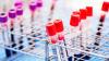 Traditional Leaders Key to Breaking HIV Silence