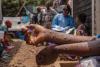 WHO declares global health emergency