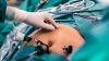 Patient Warning: Bariatric Surgery Can Get Them Drunk Faster