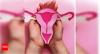 Genetics, poor lifestyle cause premature menopause in more women in Bengaluru: Doctors