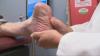Breakthrough wound healing patch helps save man's leg at St. Elizabeth Healthcare