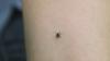 Consumer Reports: How to keep your yard tick-free