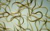 Worm towers: Nematodes build living structures that puzzle scientists