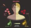 Study Highlights Role of Jaundice-Associated Pigment in Protecting Against Malaria
