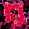 Rewrite  Fusobacterium nucleatum in colorectal cancer: Ally mechanism and targeted therapy strategies this news headline for the science magazine post