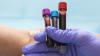 Scientists discover promising new way to filter microplastics out of human body: 'The dose makes the poison'