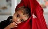 UN for urgent global action to prevent Afghan malnutrition