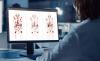 GE HealthCare Unveils Enhanced LesionID Pro at SNMMI Conference