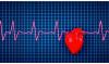 Dakshina Kannada records lowest heart attack rate; healthy lifestyle credited