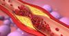 'Number one' food that unclogs arteries better than aspirin, claims doctor