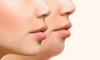 Natural Home Remedies to Slim Down Puffy Cheeks Without Cosmetic Procedures