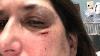 Violence against healthcare workers on the rise, Maryland nurse fighting for protections
