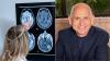Making these 11 lifestyle changes could ward off Alzheimer's, expert says