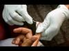 Caribbean sets pace in global decline of AIDS-related fatalities