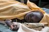 Acute cholera outbreak plagues DRC as health crisis deepens