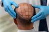 Why Men Across the UK Are Quietly Embracing Cosmetic Self‑Care