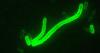 NAU scientist discusses rare human case of plague in Coconino County