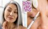 UK health chiefs' urgent warning after outbreak of paralysing botulism infections is linked to popular cosmetic treatment