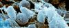 Plague Death in Arizona Shows Insidious Disease Never Disappeared