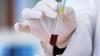 What Is Artificial Blood? Know All About the Universally Compatible Lab-Made Blood Substitute Developed by Scientists in Japan