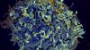 EU regulator green lights an injectable HIV drug that could help stop transmission