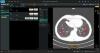 Coreline Soft Completes U.S. Patent Registration for Key Technology Enhancing AI Reliability in Healthcare