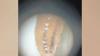 Screwworm Cases Surge to 320 Across Belize