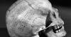 Skulls in the vault: How two scholars may have been targets for racial 'science'
