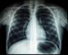 Radiochirurgia Zagreb 1st European Member of Cleveland Clinic Connected Programme