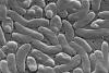 ‘Only a matter of time’: Warming ocean water will make flesh-eating bacteria that infected Cape Cod swimmer more common