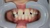 Parents left out of pocket as dentist moves to Panama