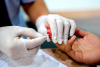 Government clarifies HIV testing guidelines amid false social media claims