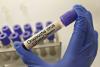 What is the latest travel advice for Oropouche virus? Tips for staying safe abroad