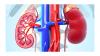 UPDATED: Tinubu subsidises dialysis treatment in public hospitals