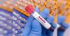 Nepal Verified for Rubella Elimination by WHO