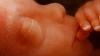Dominican Republic defends unborn in new penal code