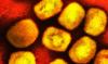 Mpox deaths, Kenya surge among top concerns in Africa's outbreaks