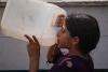 Israel destroyed Gaza’s water plants. Now a deadly condition is spreading like wildfire