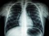 Heat-hairstyling pollution linked to lung damage and cognitive decline New research led by a Purdue University assistant professor and her Ph.D. student shows that a typical hairstyling routine involving heated tools can expose individuals to…