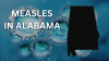 Alabama confirms first measles case since 2002 in unvaccinated child