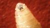 First Human Case of Deadly Flesh-Eating Screwworm Detected in the United States: A Wake-Up Call for Public Health and Agriculture